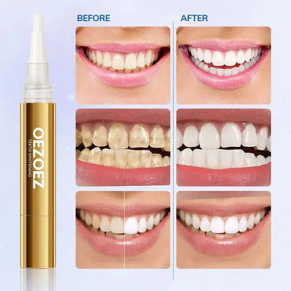 White Teeth Care for Teeth Stain Removal Dental Care YSLYSL