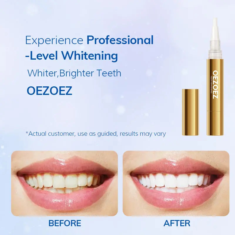Dental Care White Teeth Care Teeth Remove Stains YSLYSL
