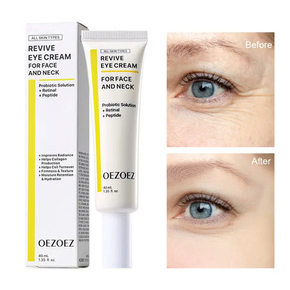 Eye Cream Is Suitable for Sensitive Skin Brightening and Moisturizing YSLYSL