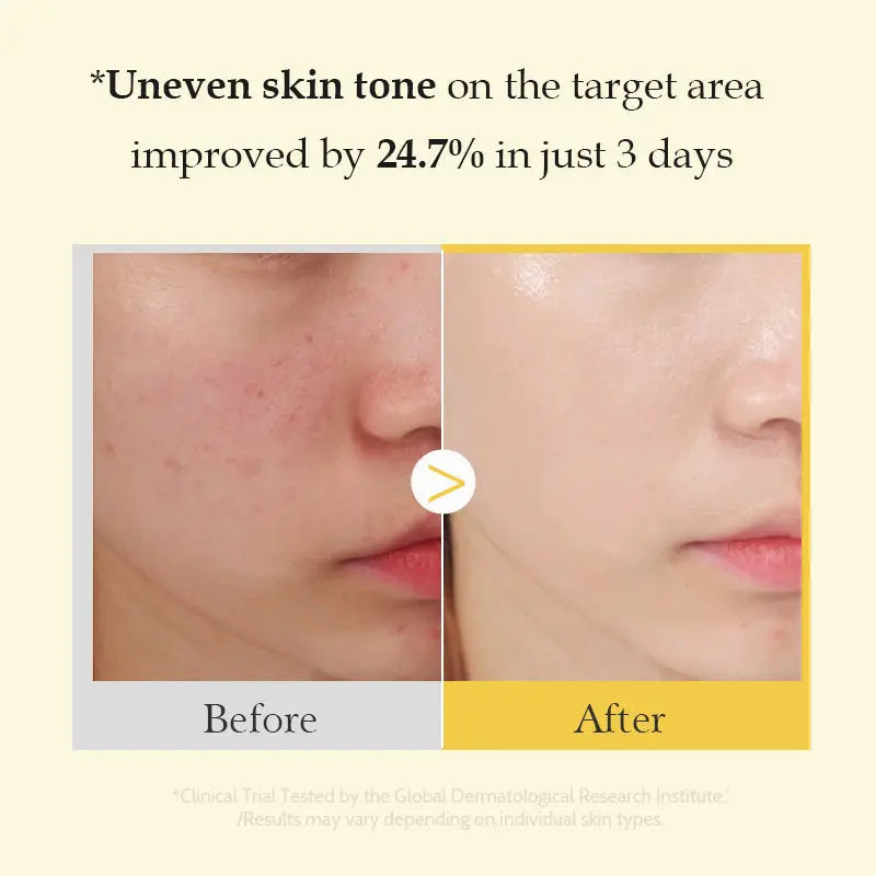 Turmeric Night Gel Mask Hydrating Hydrating Mask YSLYSL