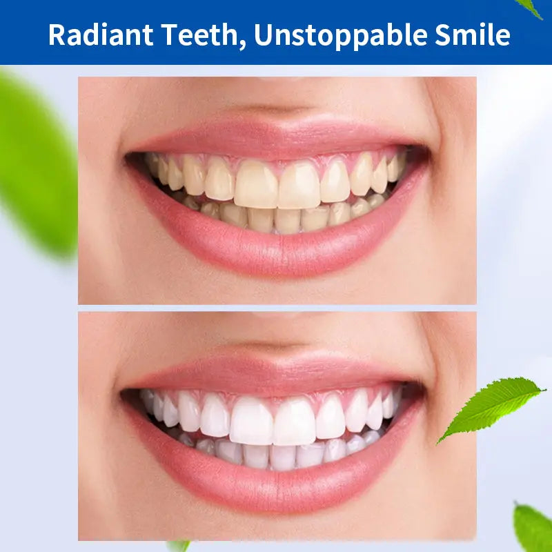 White Teeth Care for Teeth Stain Removal Dental Care YSLYSL